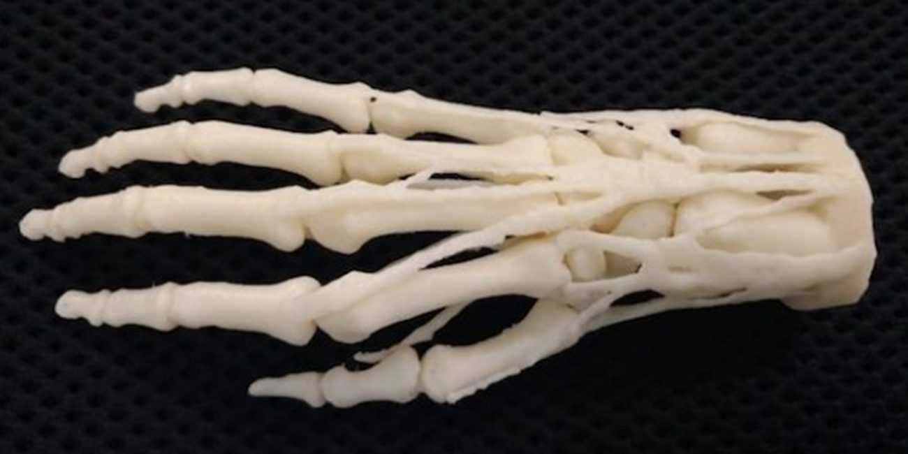 American hospitals will begin to print the prosthetics on 3D printers