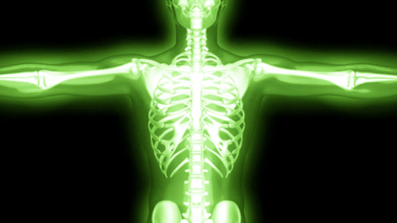 Che la radiazione fa con il corpo?