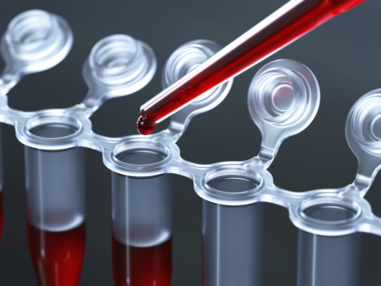 발명의 새로운 종류의 혈액 테스트를 위한 암 진단