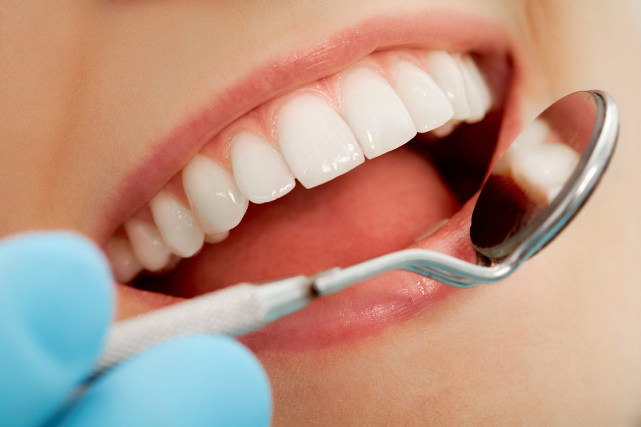 Канадські вчені створили майже вічні зубні пломби
