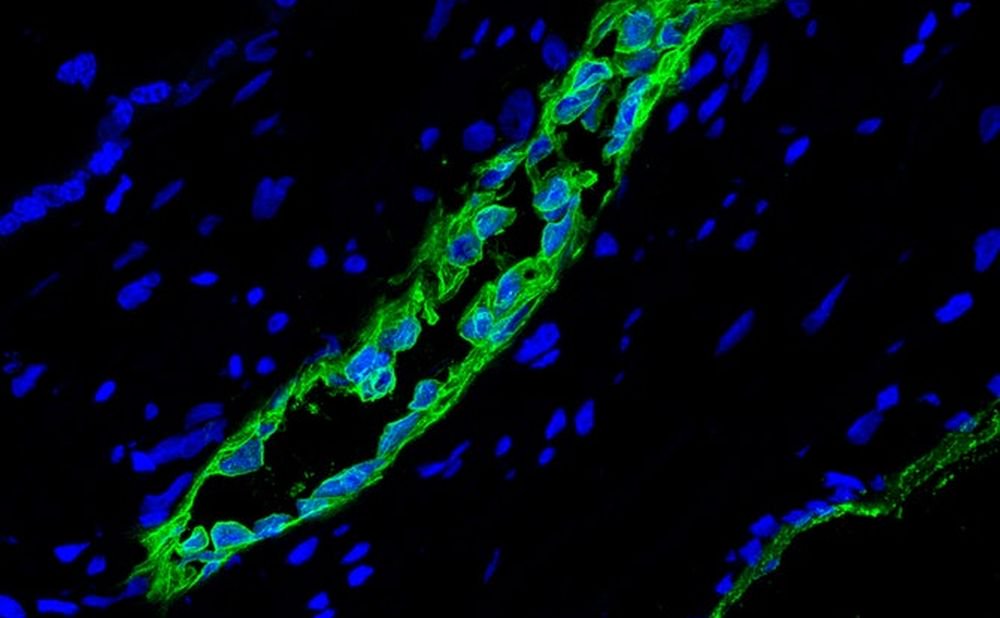اكتشف العلماء نوعا جديدا من الخلايا الجذعية