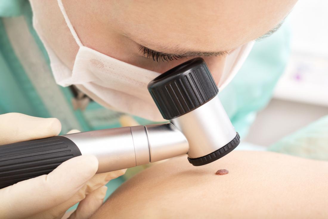 黑色素瘤的疫苗提供了100%的存活在测试期间