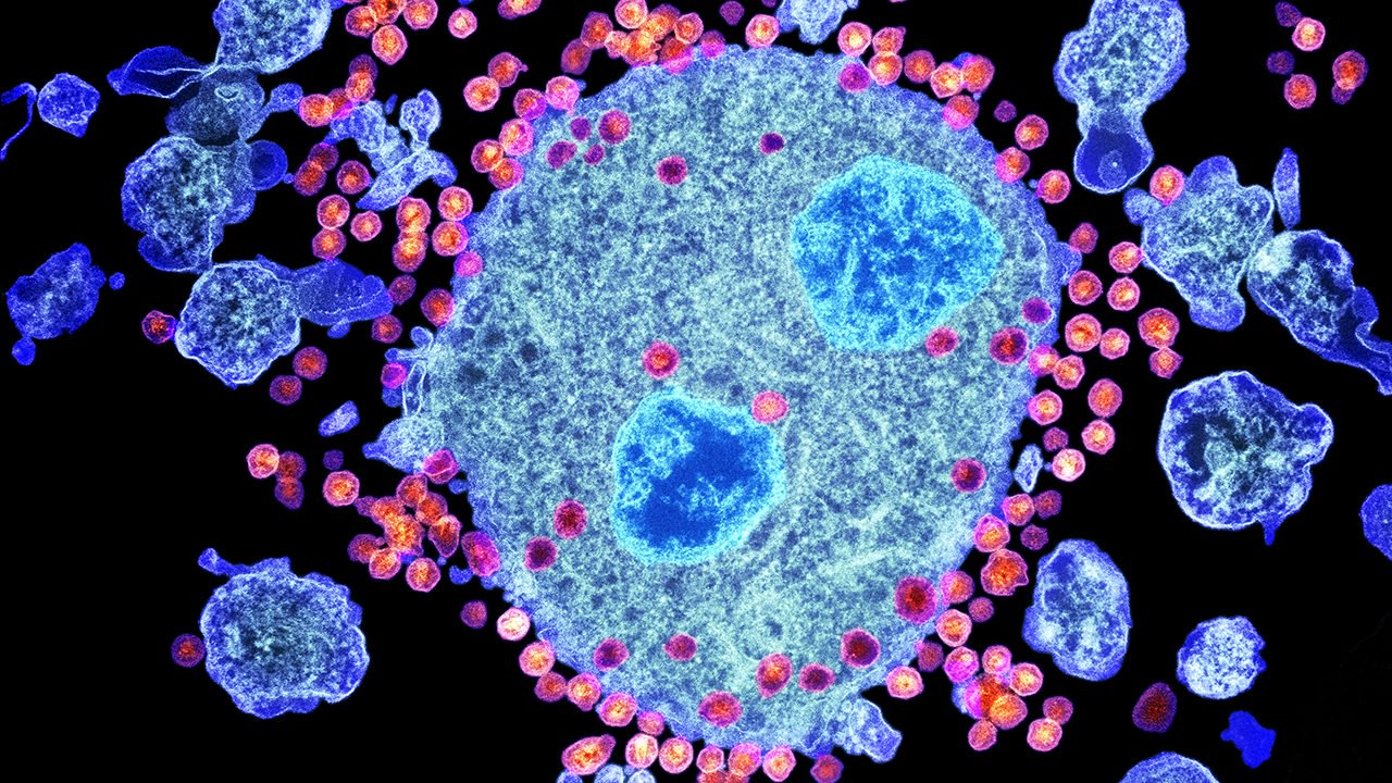 実験免疫療法のHIV感染経過の初期段階の実験の安