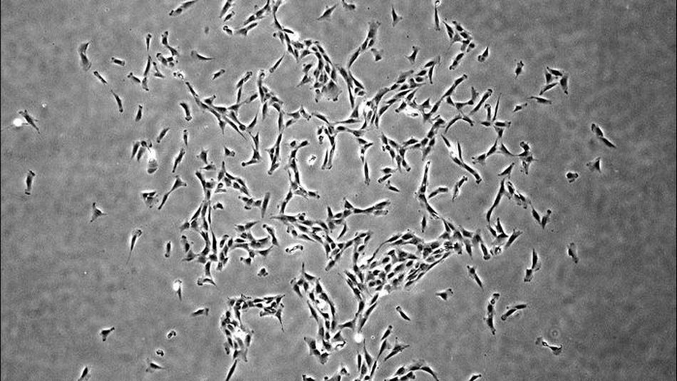 Die Wissenschaftler zum ersten mal identifiziert knöcherne menschliche Stammzellen