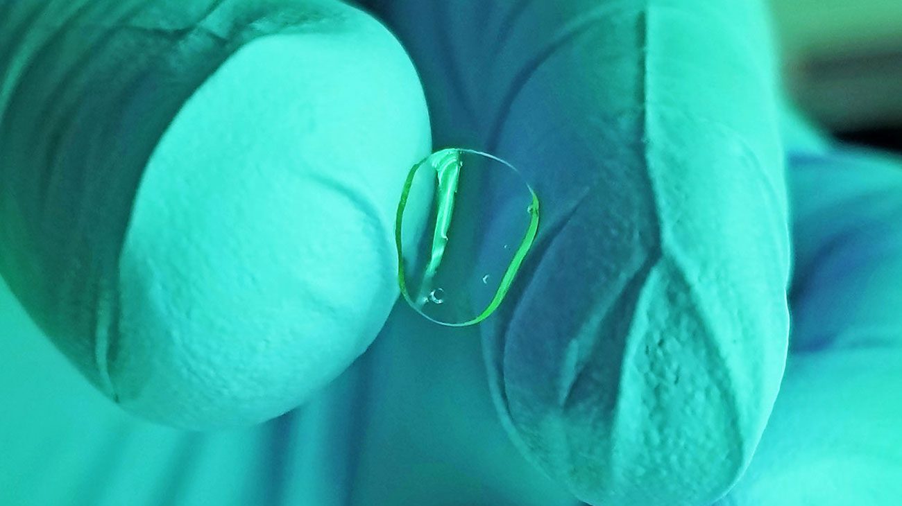 Die erste künstliche Hornhaut, gedruckt auf einem 3D Drucker, der schon bereit für die Transplantation