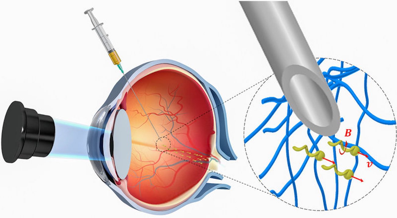 Nanorobots रोगों के इलाज के लिए पहले शुरू की थी में मानव आँख