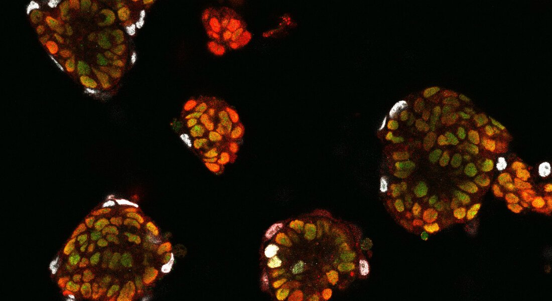 Wissenschaftler haben herausgefunden, wie Stammzellen «verstehen», in welcher Zelle Sie sich zu entwickeln