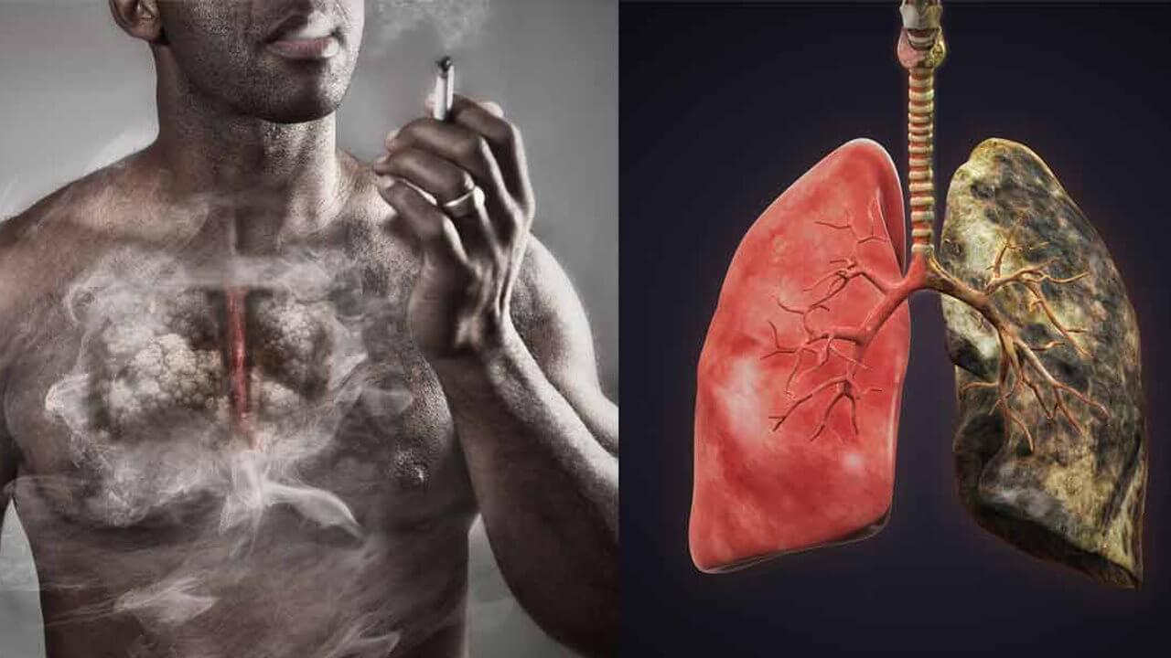 Відновлюються клітини легенів після того, як чоловік кинув палити?