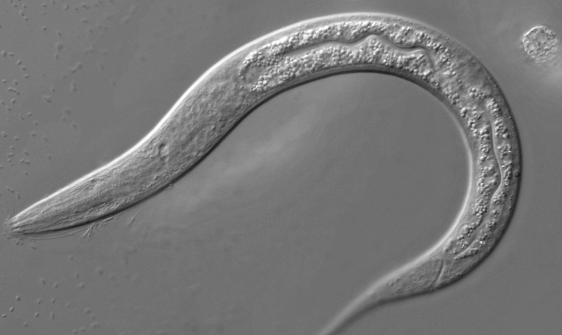 Die Würmer sind in der Lage, zu finden bei Menschen 15 Arten von Krebs