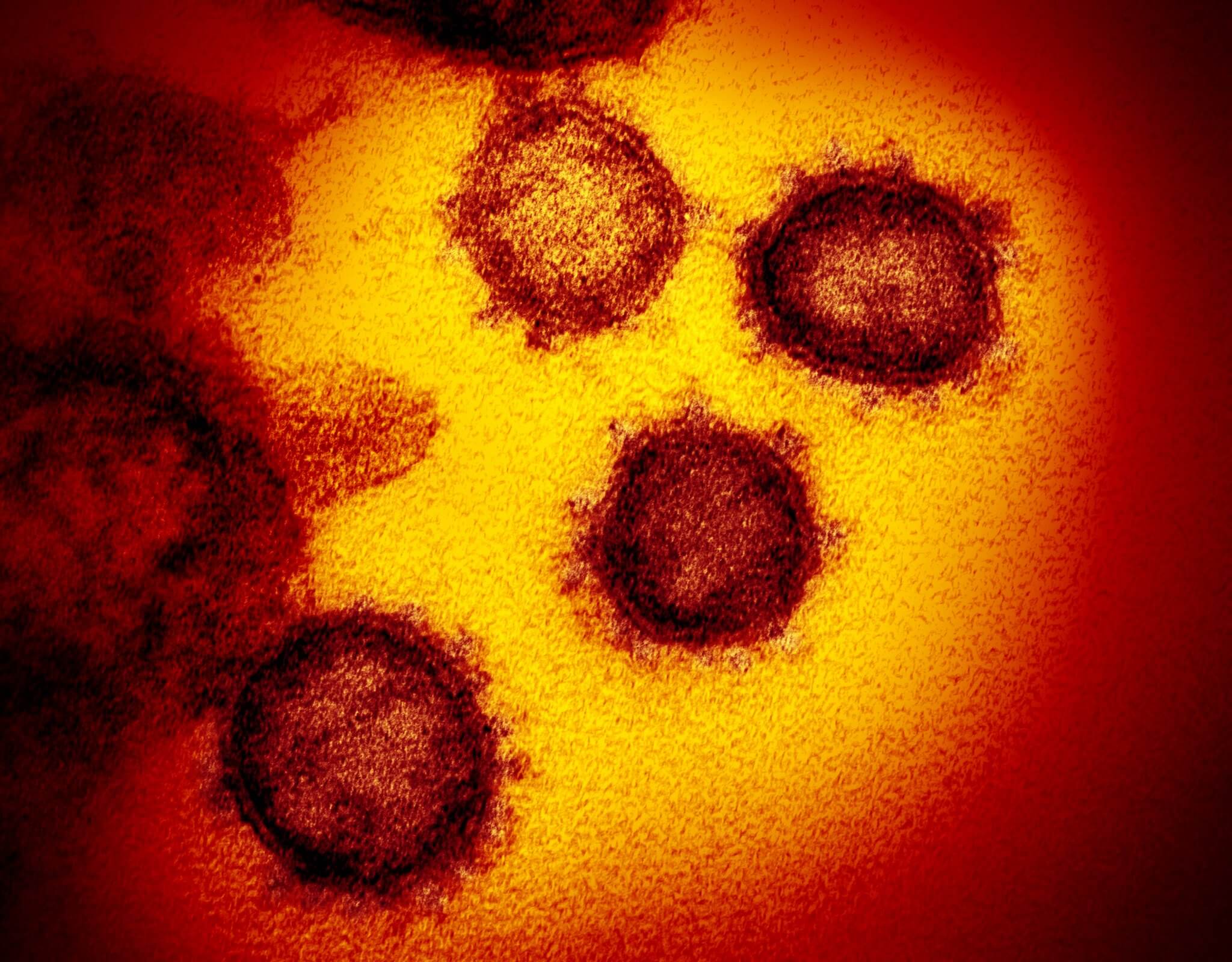 Como uma mutação do novo coronavírus e será que ele é mais perigoso com o tempo?