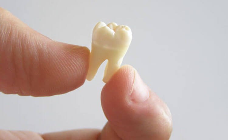 لماذا نحن بحاجة إلى أسنان الطفل كما تنمو