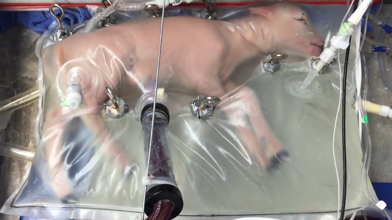Scientists have created an artificial womb for premature babies