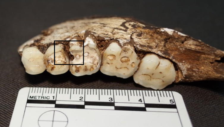 चीनी कुछ भी नहीं है इसके साथ करने के लिए: हमारे प्राचीन पूर्वजों एक ही था उनके दांत के साथ समस्याओं