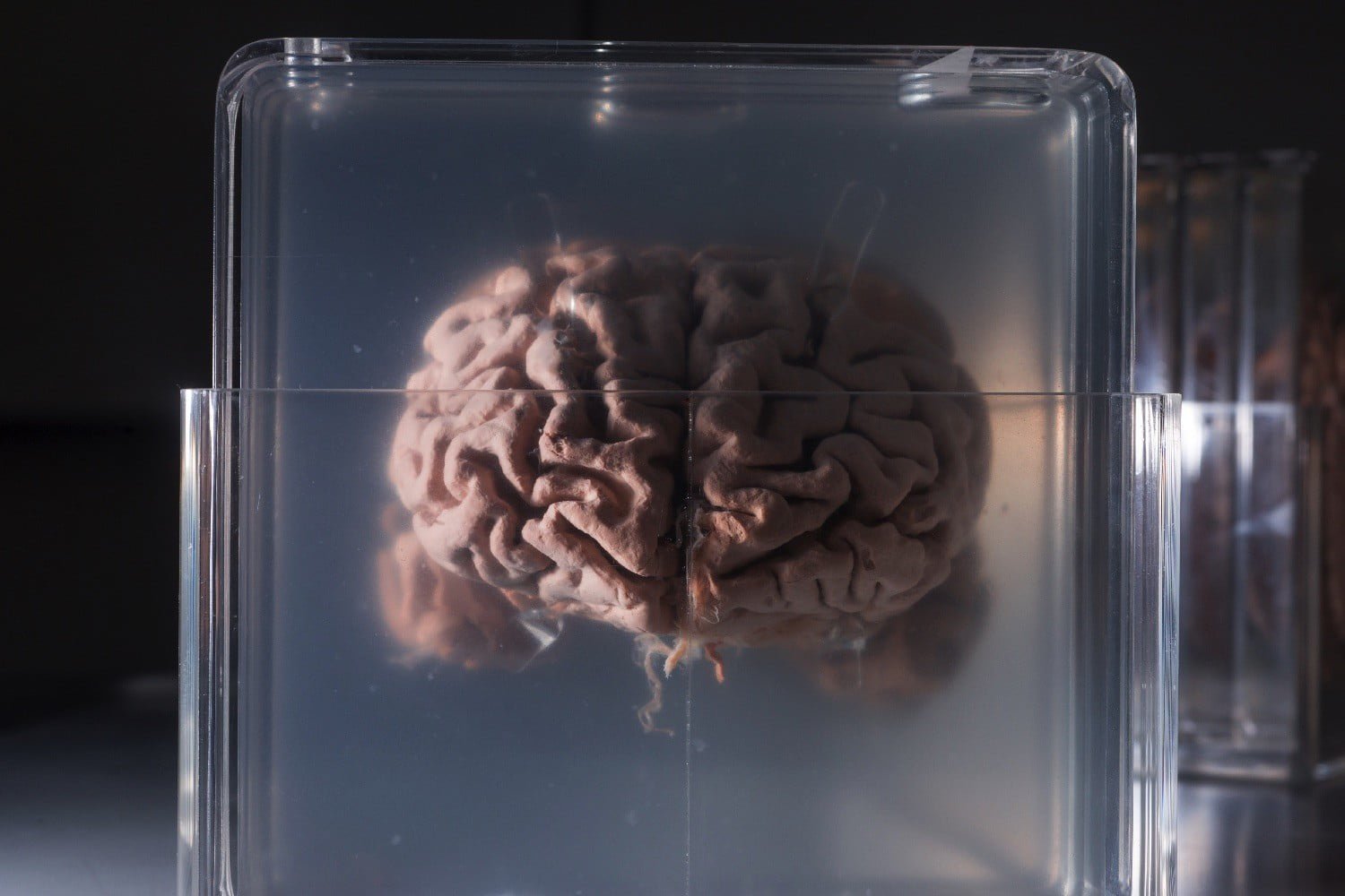 The company offers to freeze your brain for digitization in the future