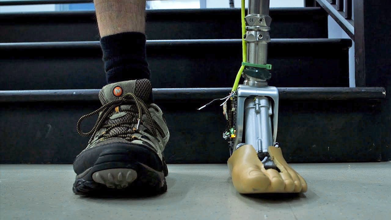 Designed an artificial ankle that adapts to irregular surfaces