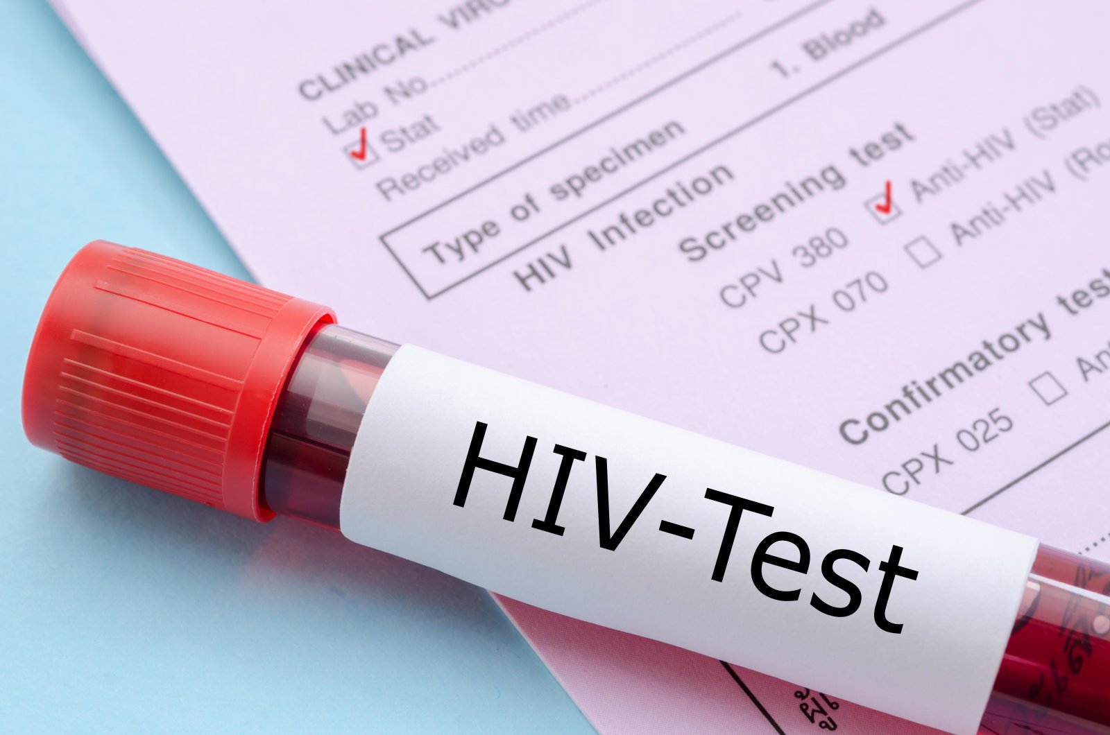 New HIV vaccine has shown good results in human trials