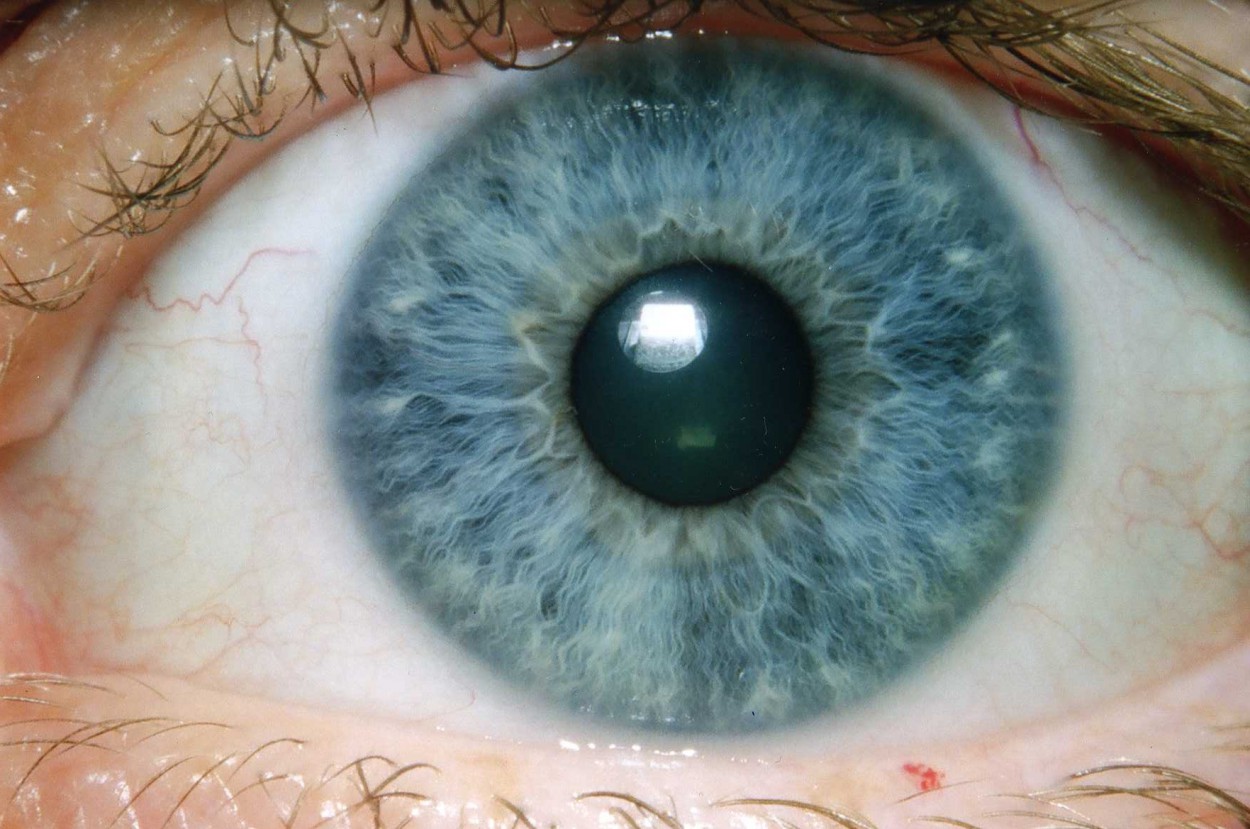 جوجل أنشأت منظمة العفو الدولية من أجل تشخيص أمراض العين