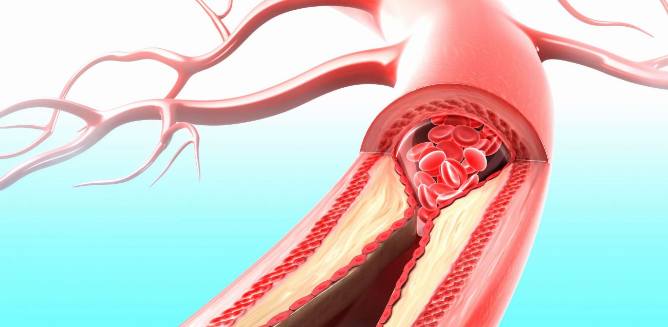 Die App informiert über Erkrankungen des Herzens und der Blutgefäße ohne Schnitte und Stiche