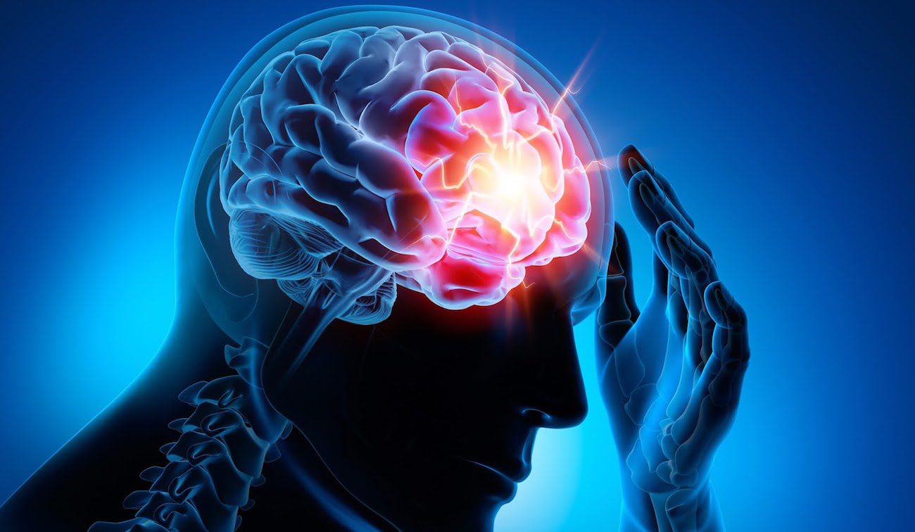 Hirn-Implantat geholfen zu heilen Epilepsie bei Mäusen