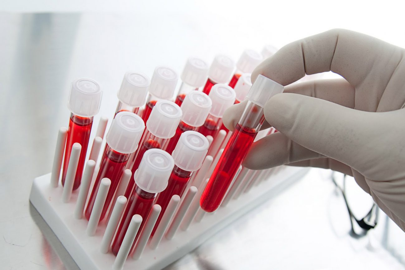 Nowy badanie krwi pomoże dowiedzieć się o ryzyku nawrotu raka