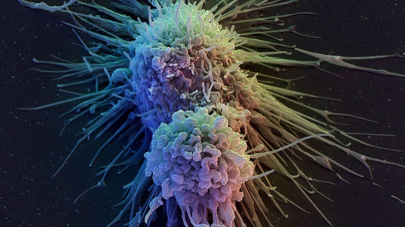 から皮膚細胞の細胞は、免疫システムです。 でのがん治療
