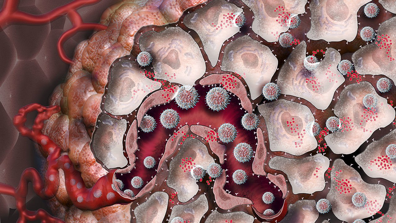 Gibi nanomalzemeler boyunca mücadele tümörler?