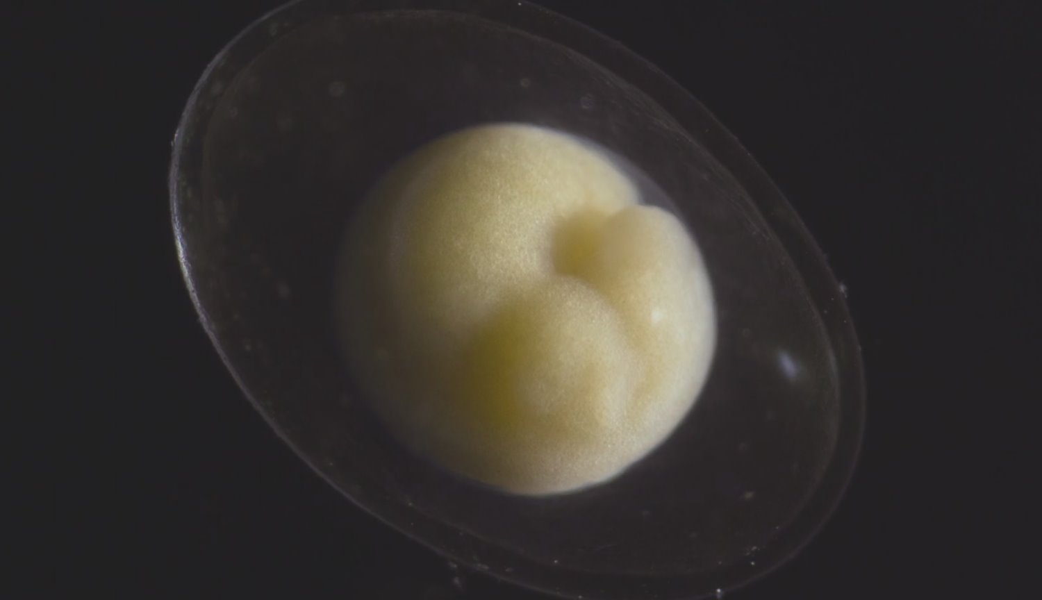 #video | Gibi küçük bir embriyo haline güzel bir canlı organizma?