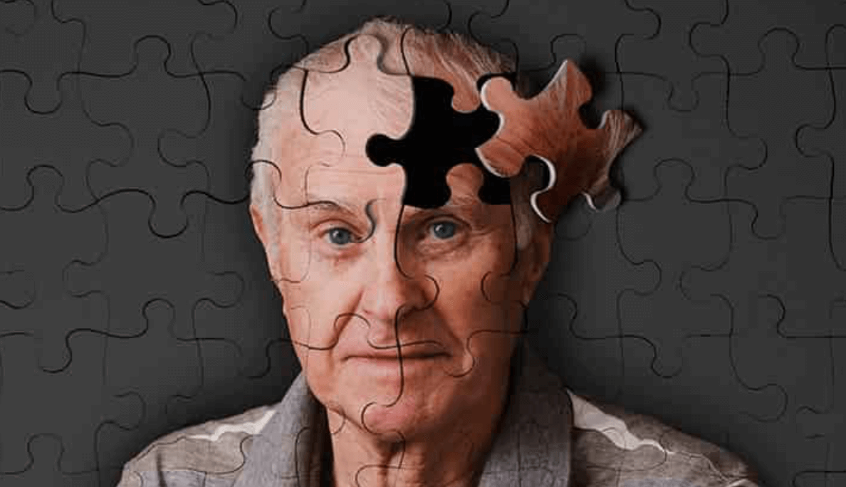 Depression can cause the development of Alzheimer's disease