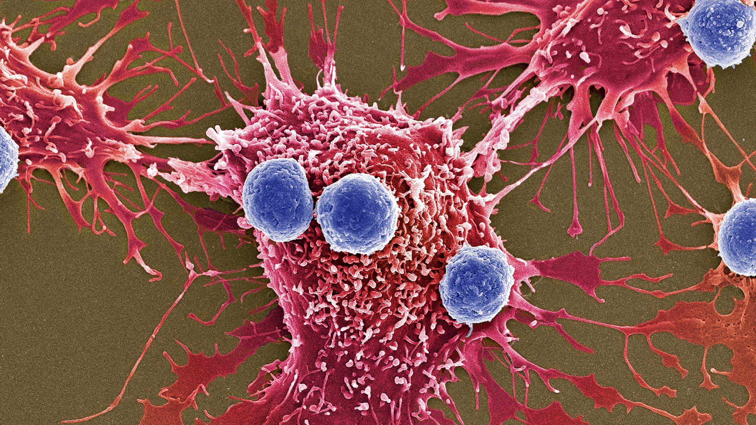 Zur Verbesserung der überlebensrate von Krebszellen fressen ihresgleichen