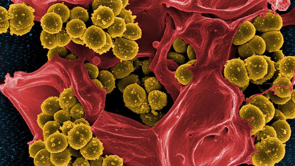 Mikrober, långsam ett antibiotikum som utvecklar resistens mot andra