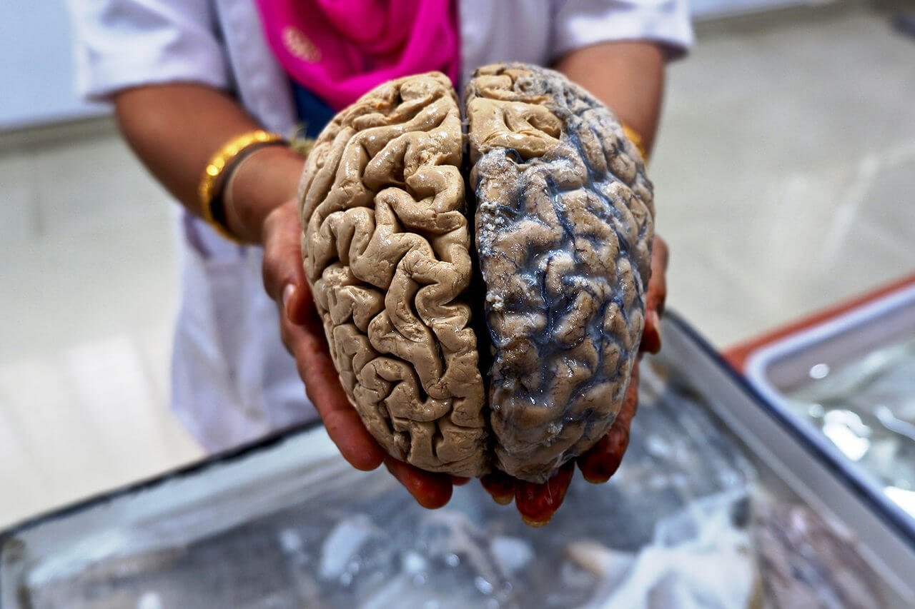 Kan den menneskelige hjerne ikke er forfald i tusinder af år?