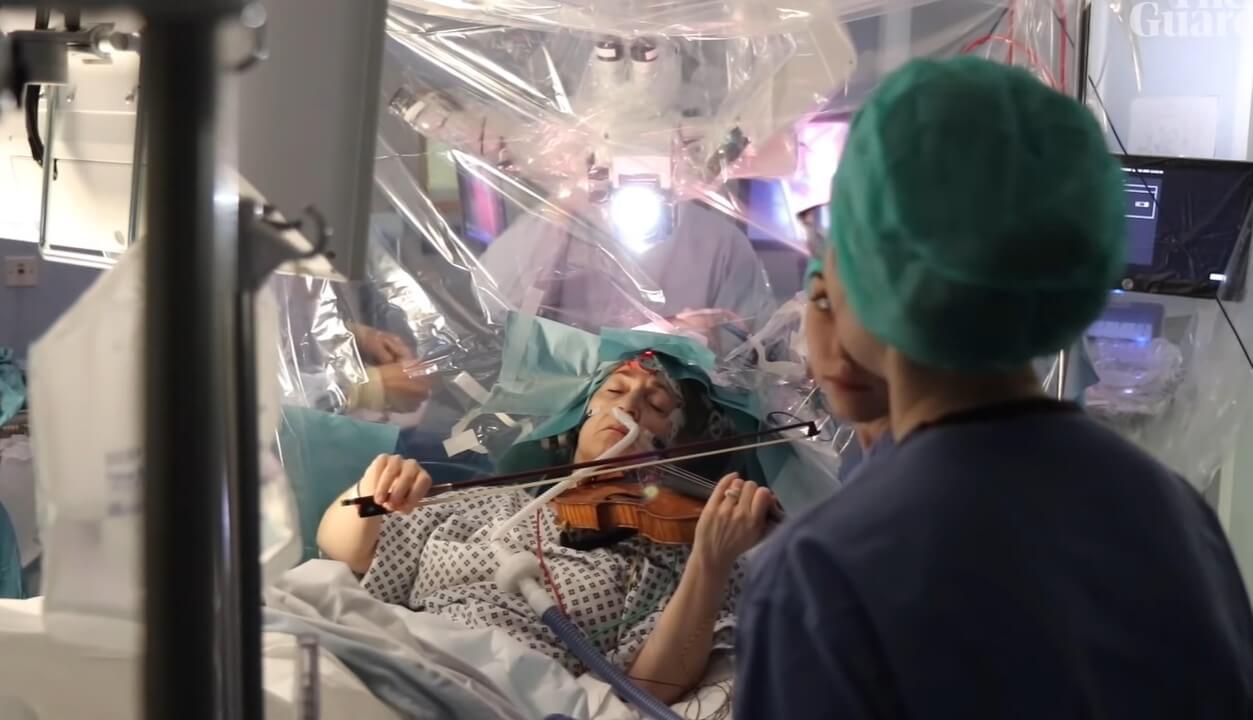 ¿Por qué los cirujanos le pidieron a la mujer a tocar el violín durante una operación en el cerebro?
